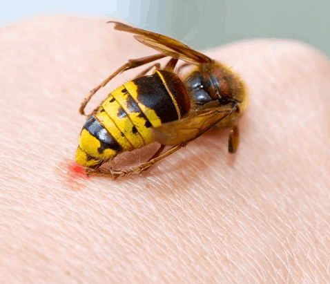 How to Avoid Getting Stung?